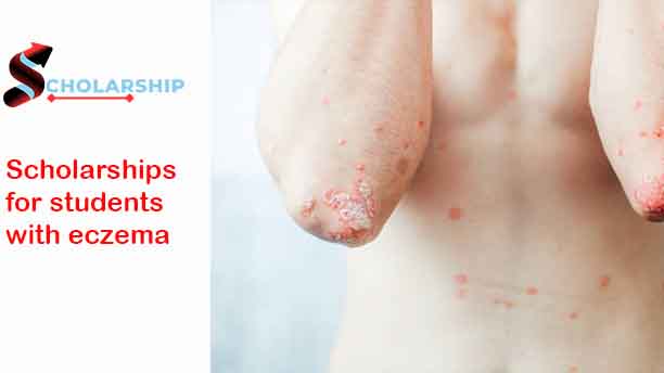 Scholarships for students with eczema